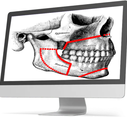 Orthognathic surgery