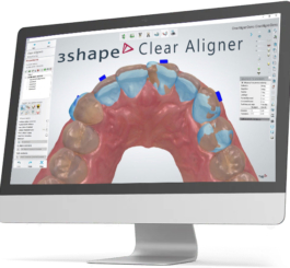 clear aligner 2