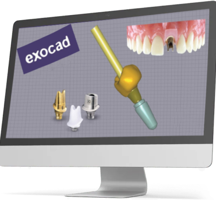 کاستوم اباتمنت